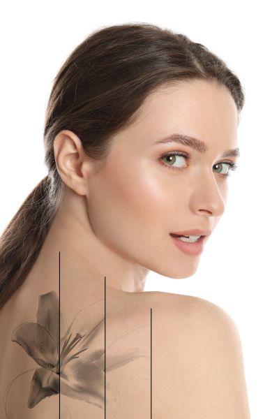 Design with photo of woman on white background during tattoo removal process
